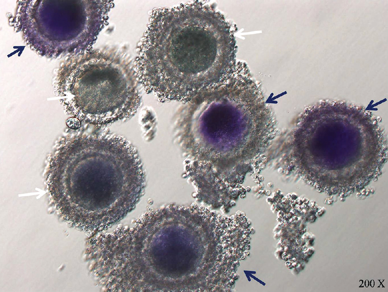 Brilliant cresyl blue stained oocytes: Blue stained oocytes are designated as brilliant cresyl blue +ve (blue arrow) and colourless oocytes are designated as brilliant cresyl blue −ve (white arrow).